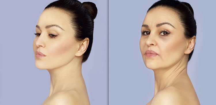 lifting facial