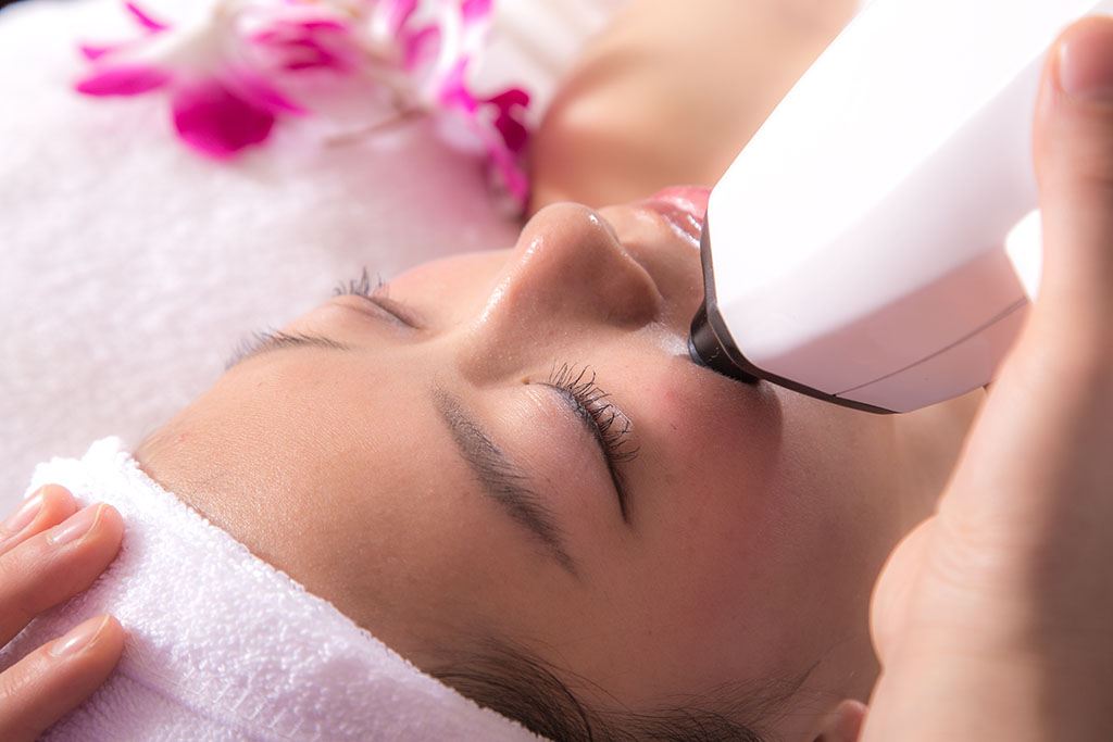 epilare cu laser