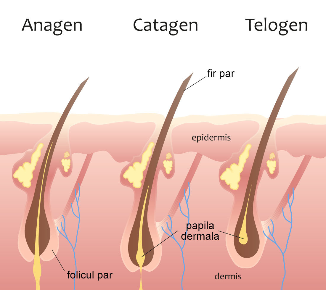 epilare cu laser