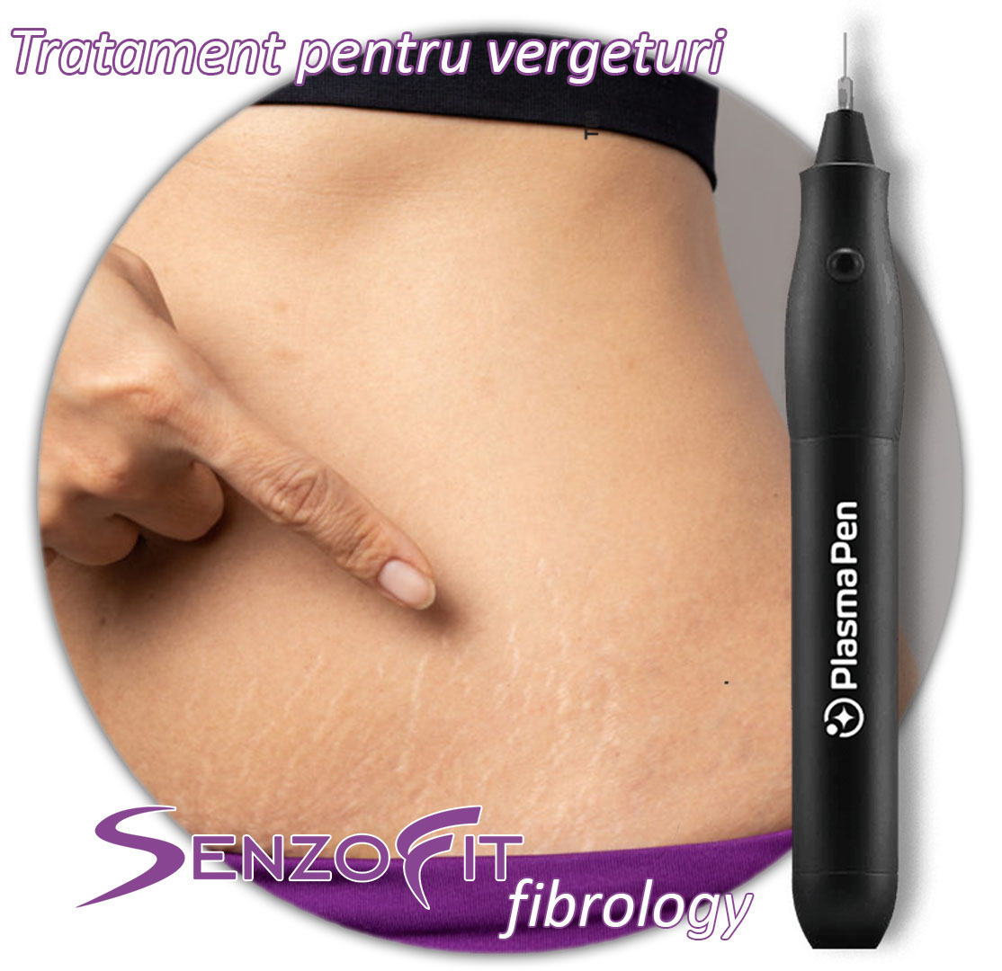 elimina vergeturile
